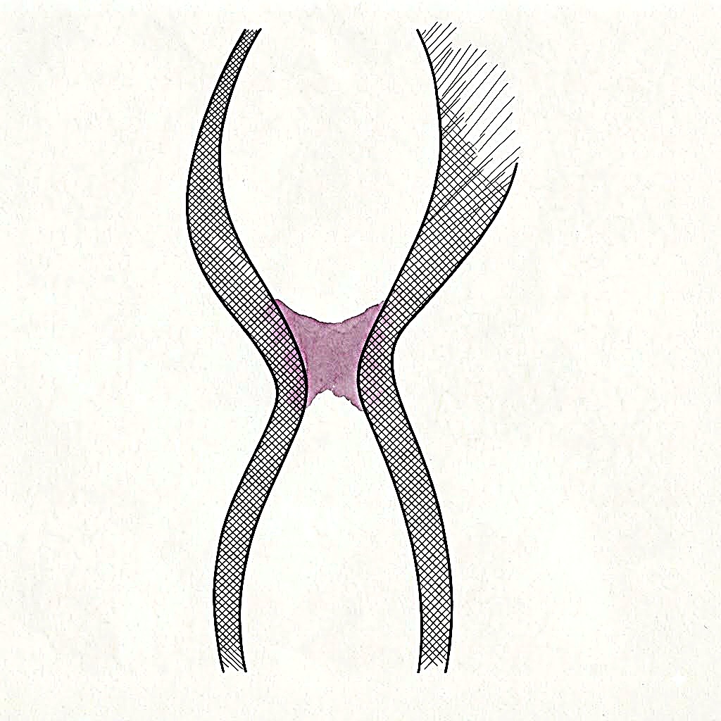 Interval — crossing forms